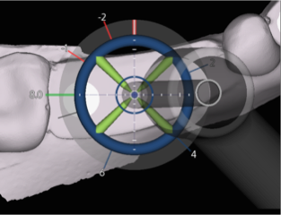 X-Guide Diagram