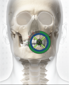 Skeleton